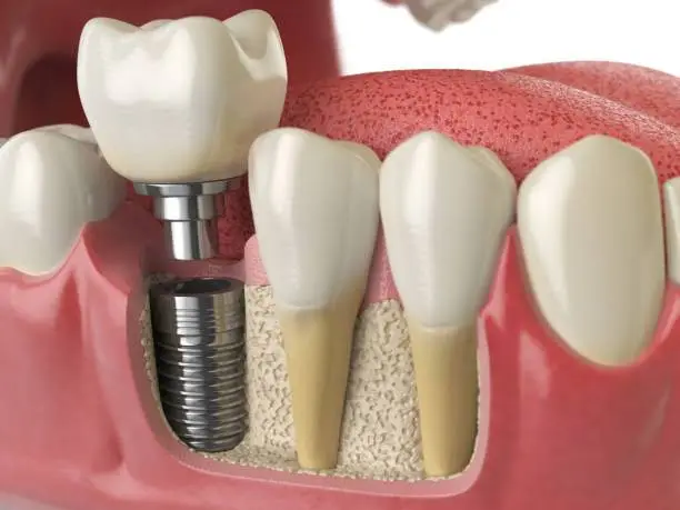Center for Cosmetic and Sedation Dentistry