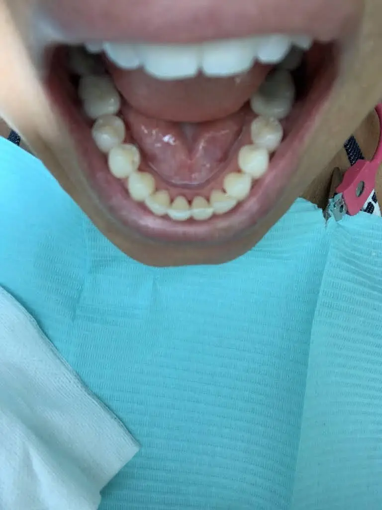 Shawn A. Walls, DDS