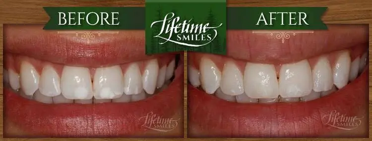 Lifetime Smiles: Dr. Jim Forester
