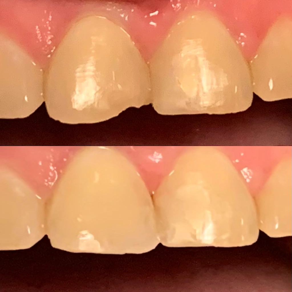 Cumming Dental Smiles