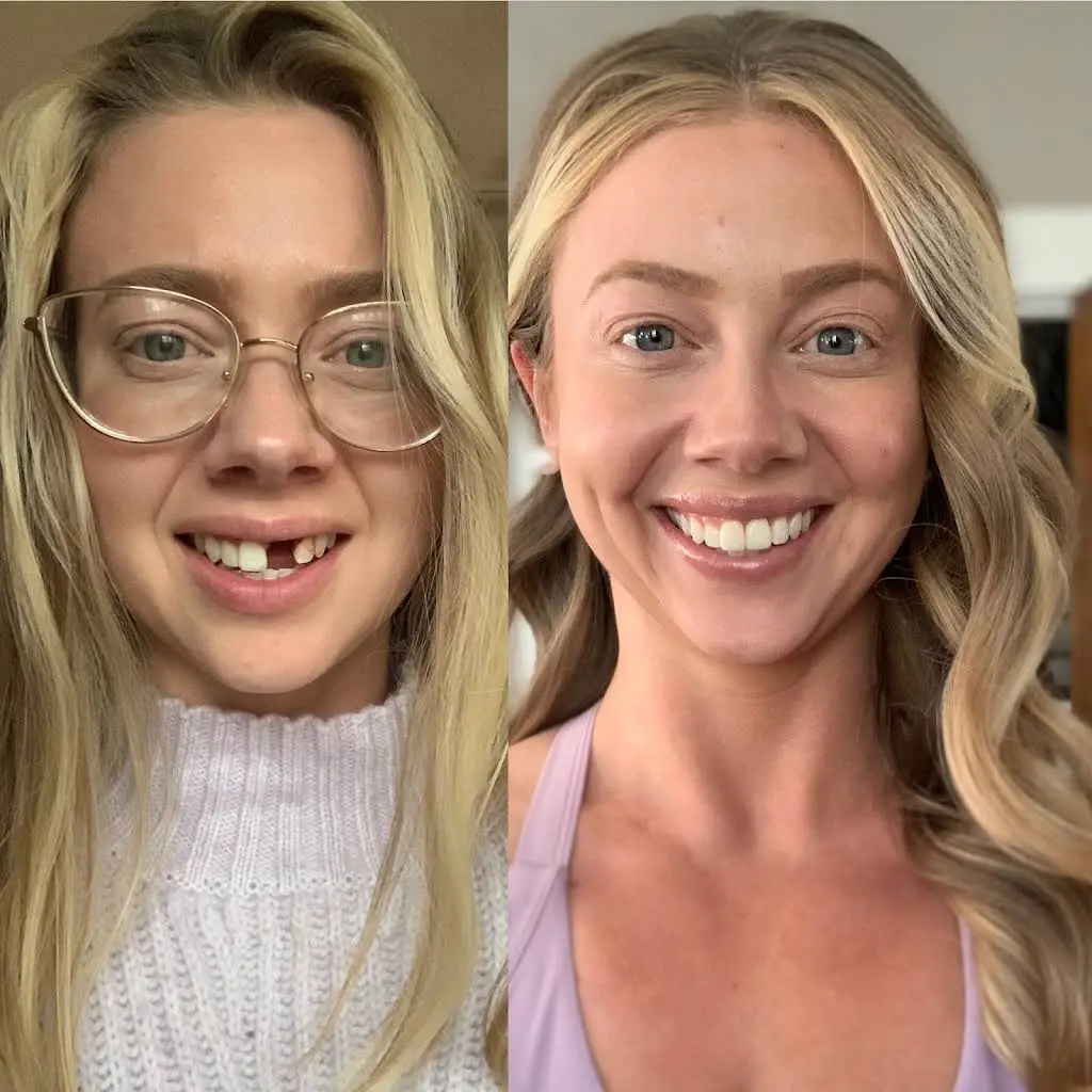 Dentistry For Smiles
