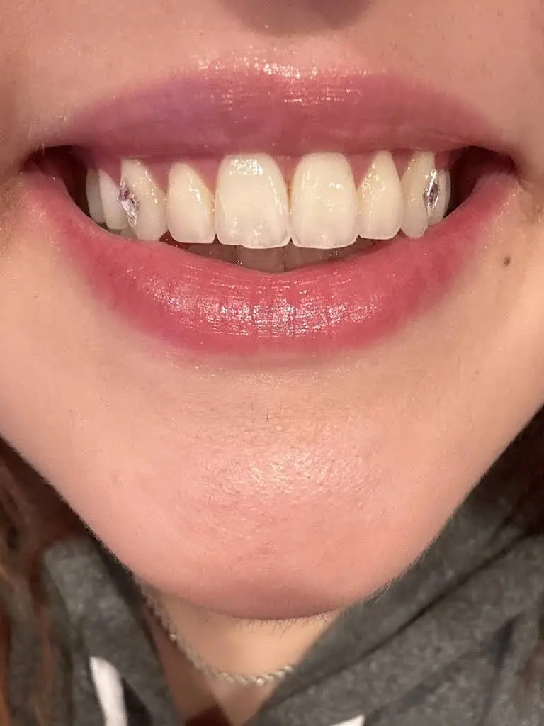 The Tooth Jeweler