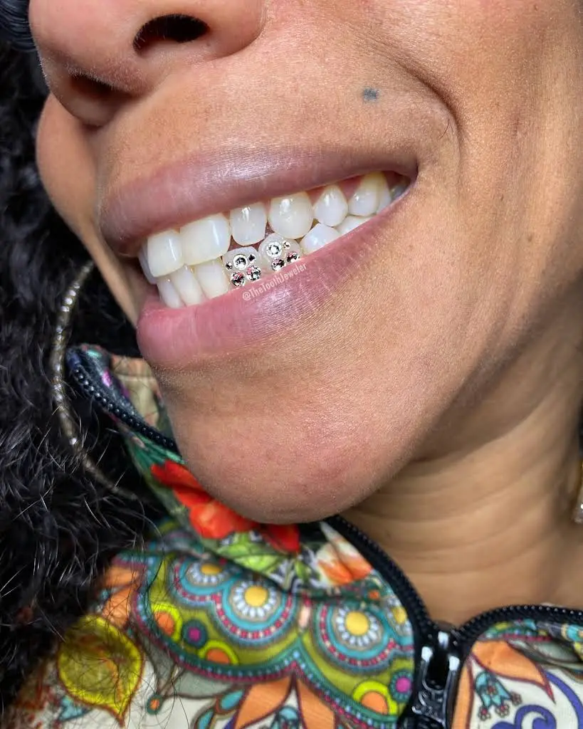 The Tooth Jeweler