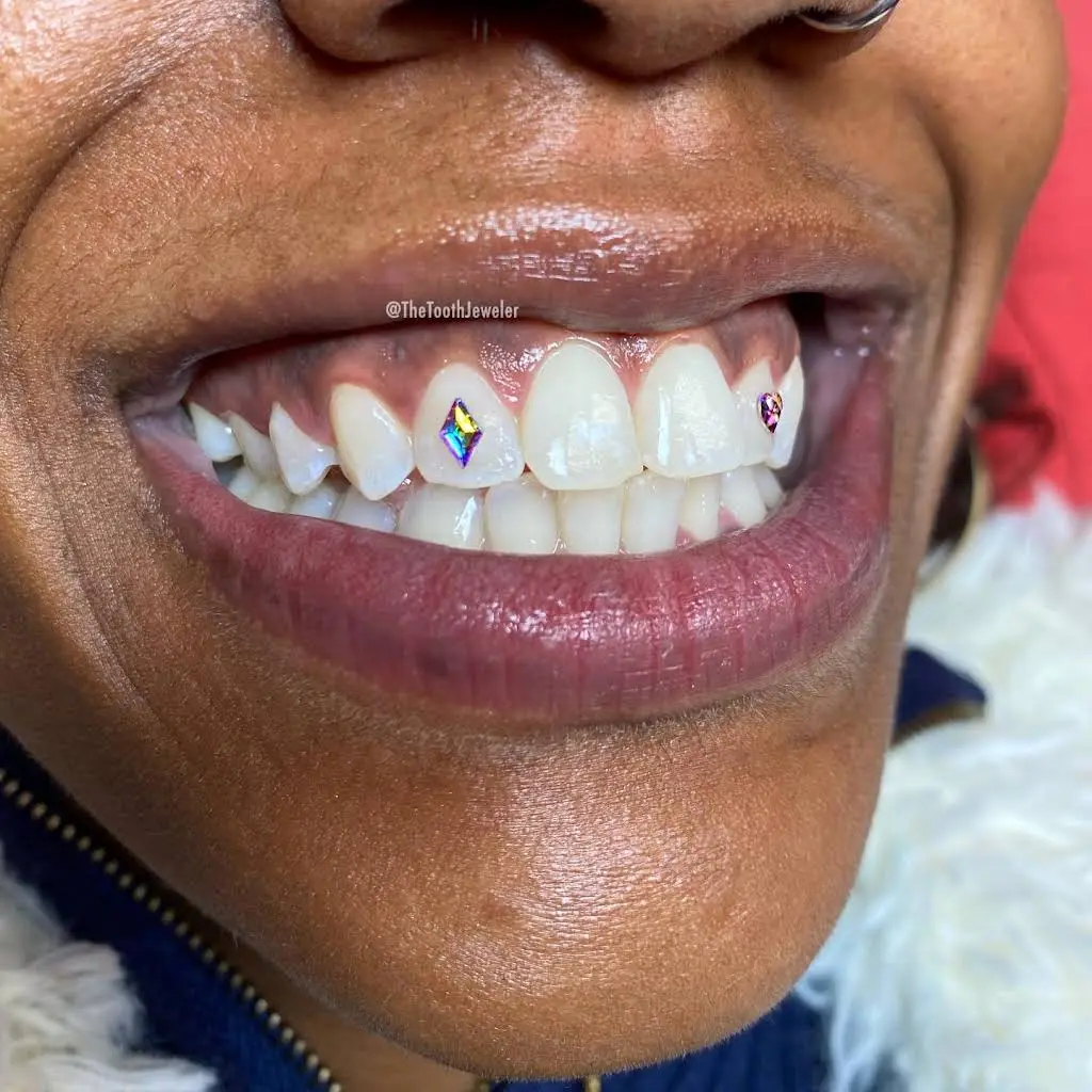 The Tooth Jeweler