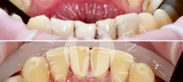Omni Family Dental