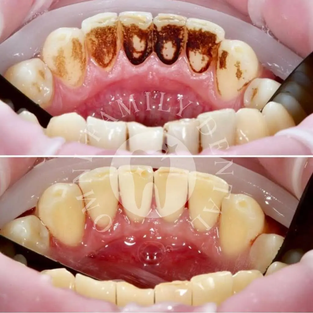Omni Family Dental