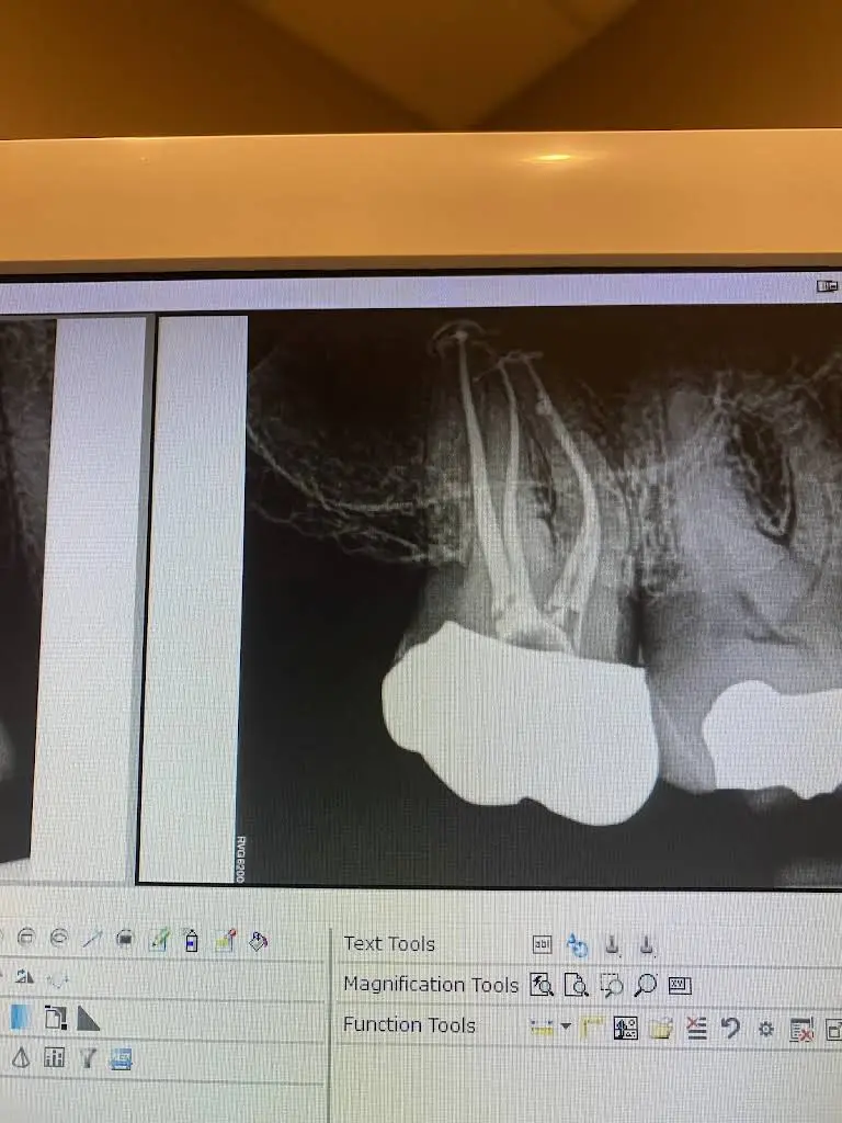 Soft Touch Endodontics