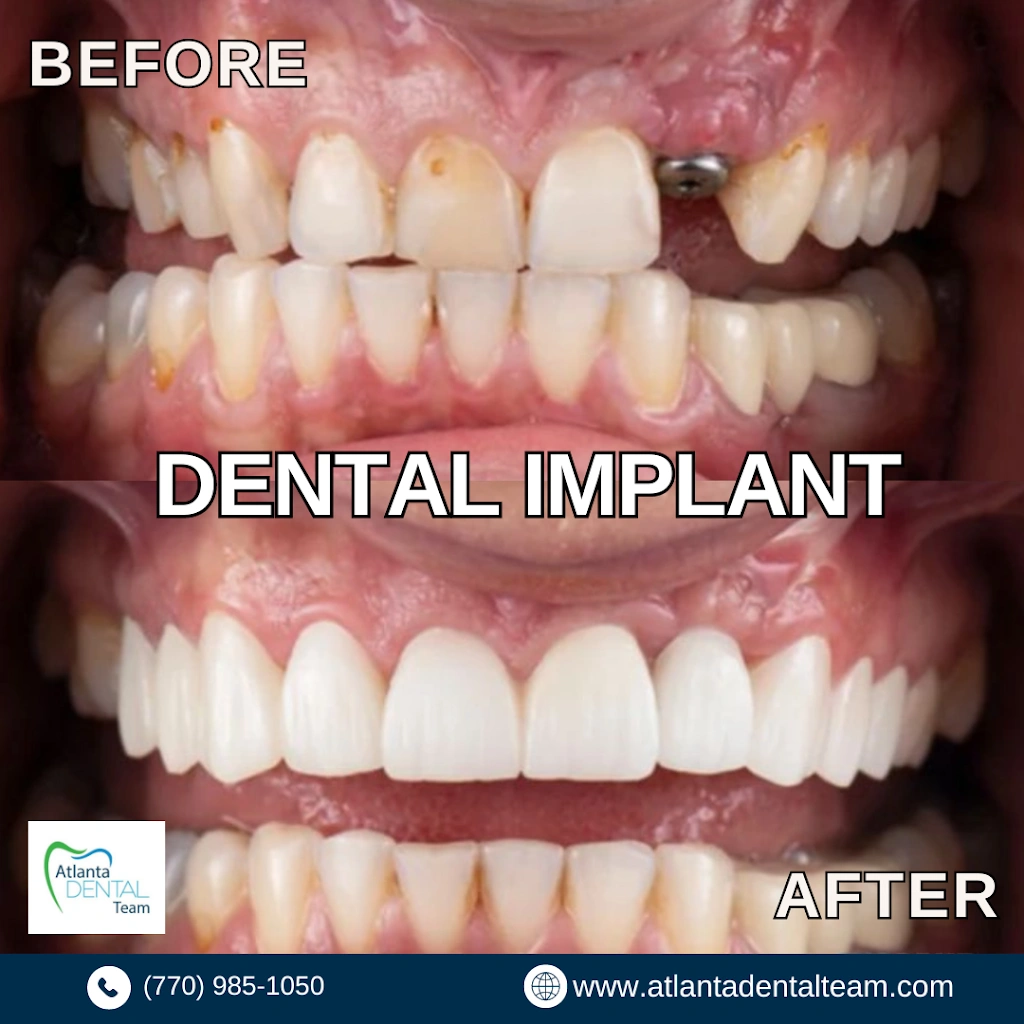 Atlanta Dental Team