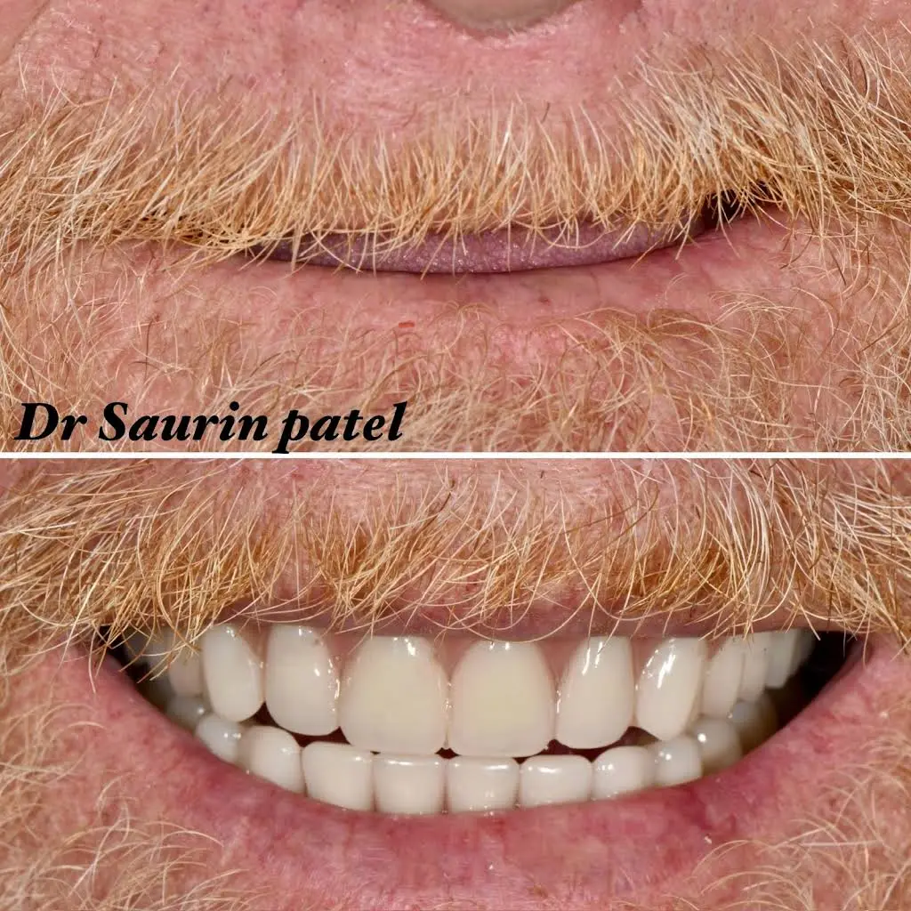 Ivory Dental