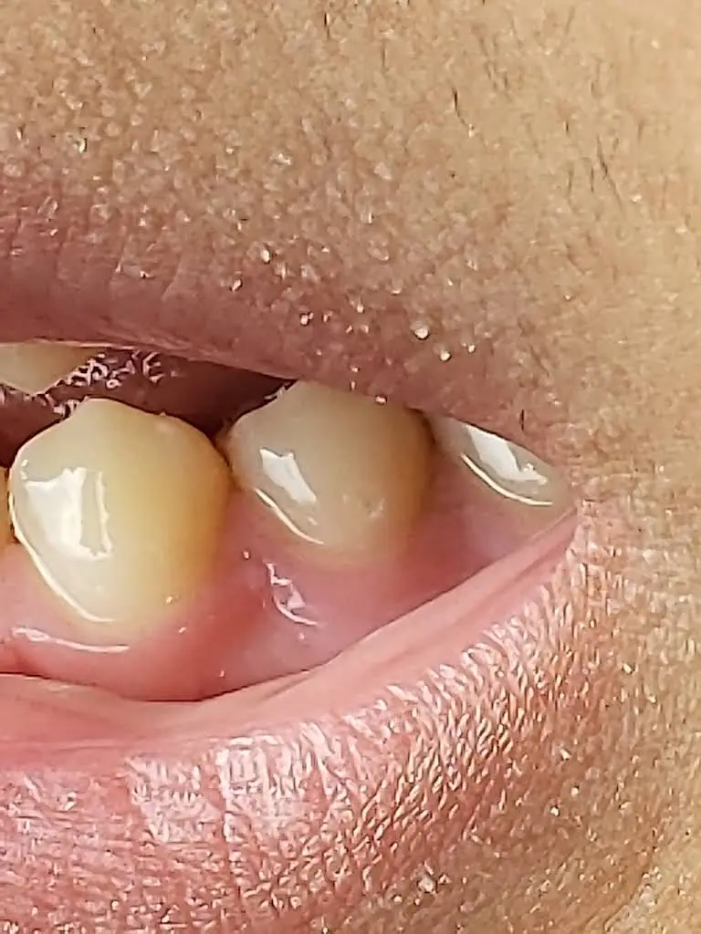 Healthy Smiles of Lawrenceville