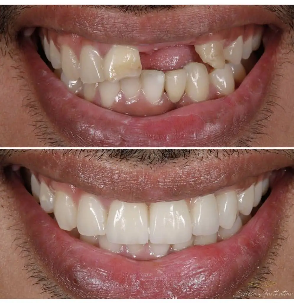 Zona Dental Atlanta