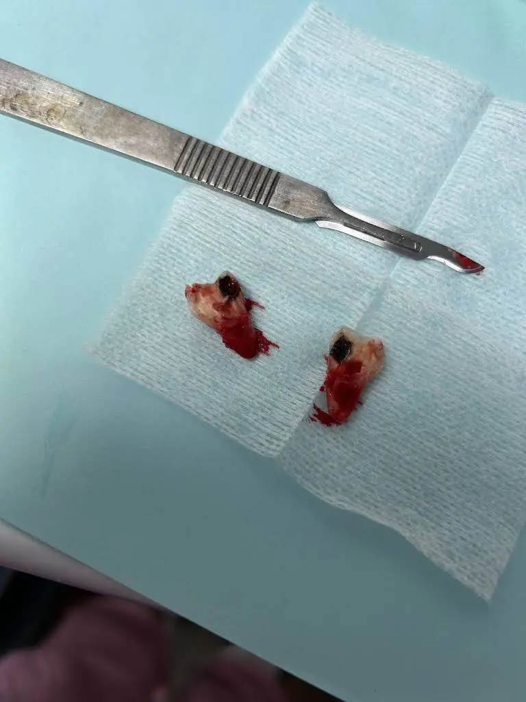 Zona Dental Atlanta