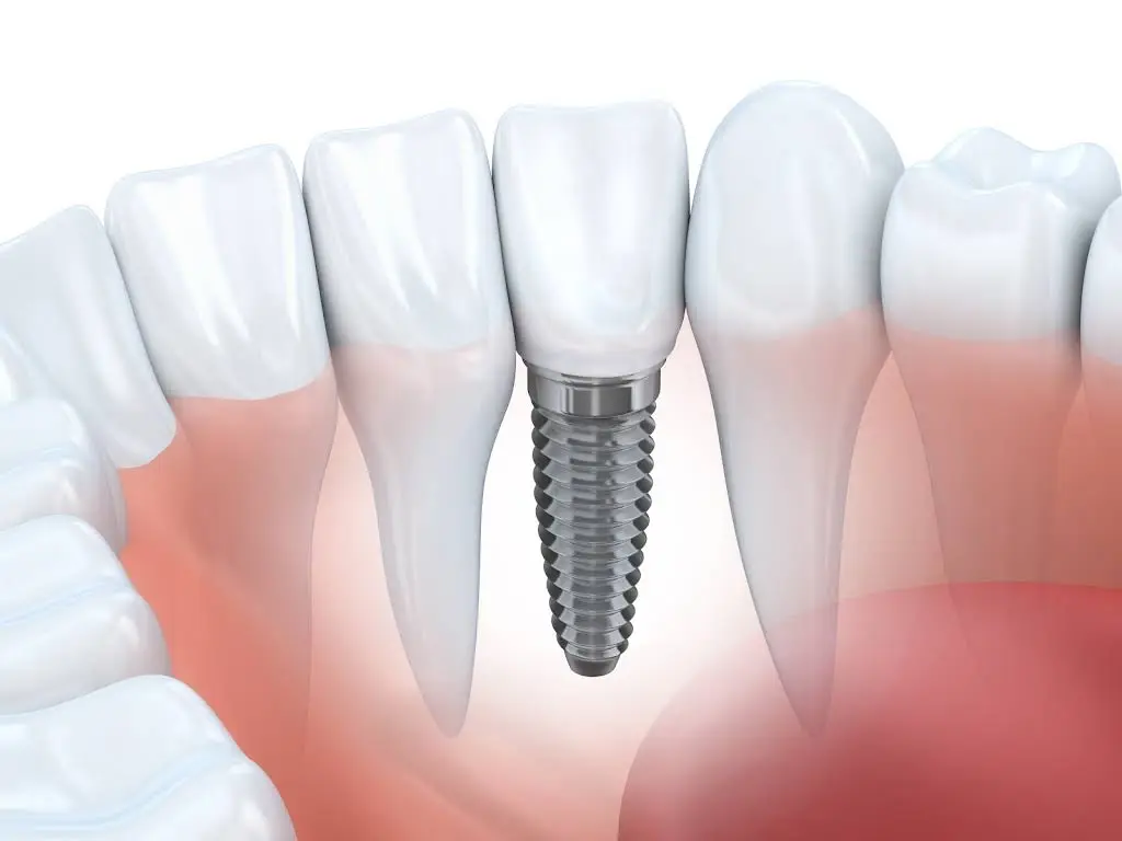 West Periodontics