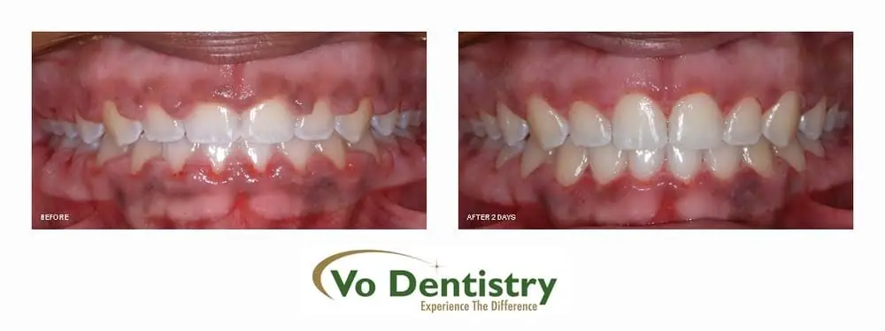 Vo Dentistry