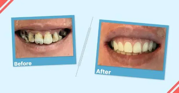 Buford Dental