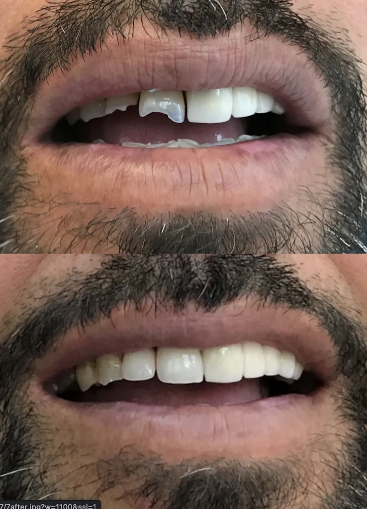 Buford Dental