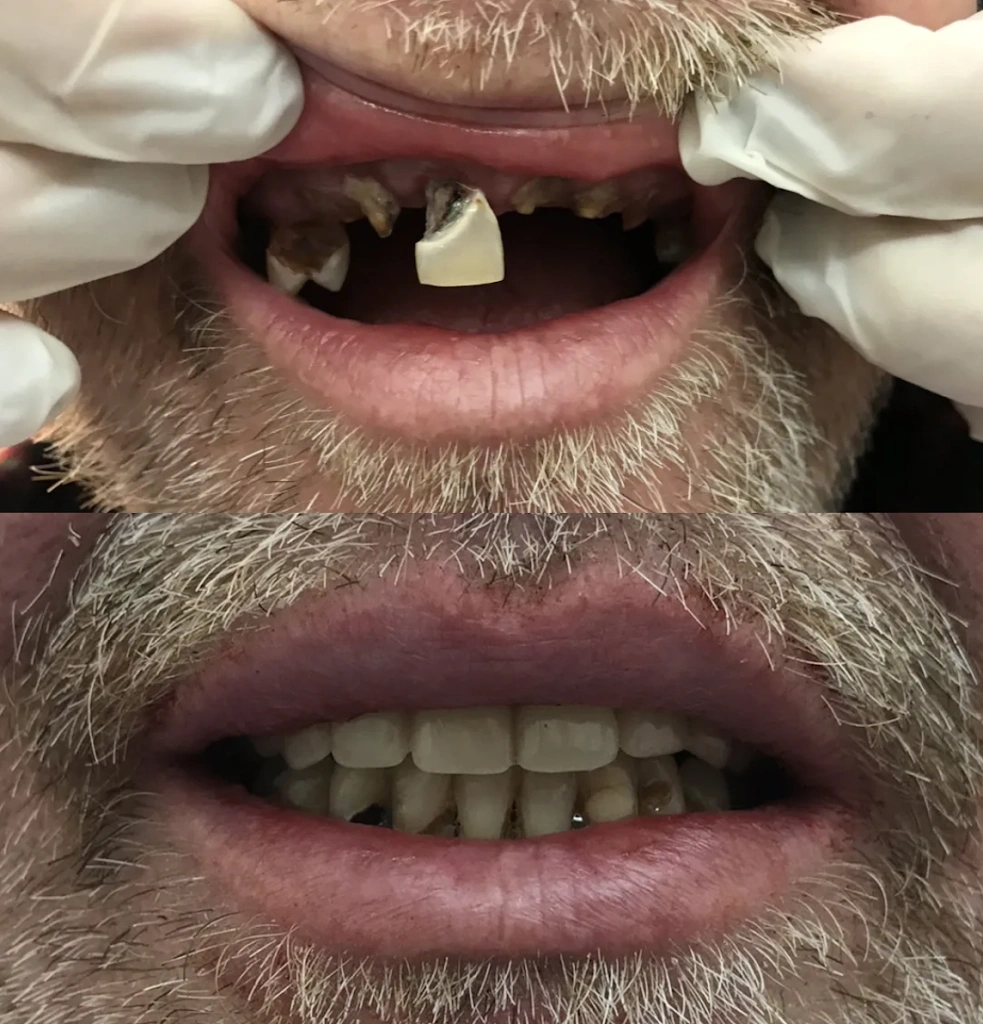 Buford Dental