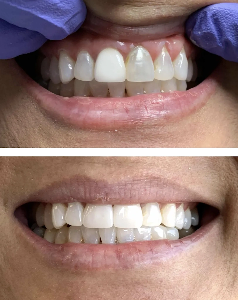 Buford Dental