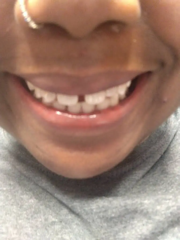 Dental Smiles At Dacula