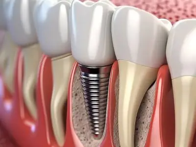 Hamilton Mill Dental