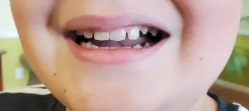 Natural Smiles