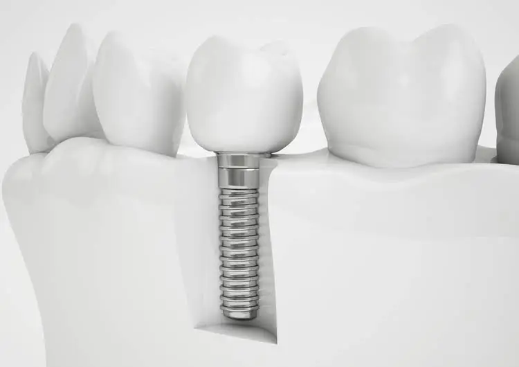 McKenzie Family Dentistry