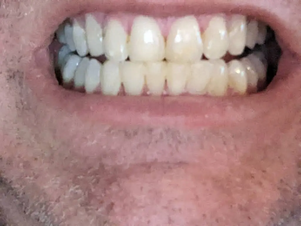 Dental Care at Barrow Crossing