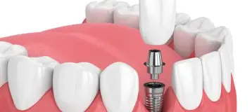 Nevada Dentistry & Braces