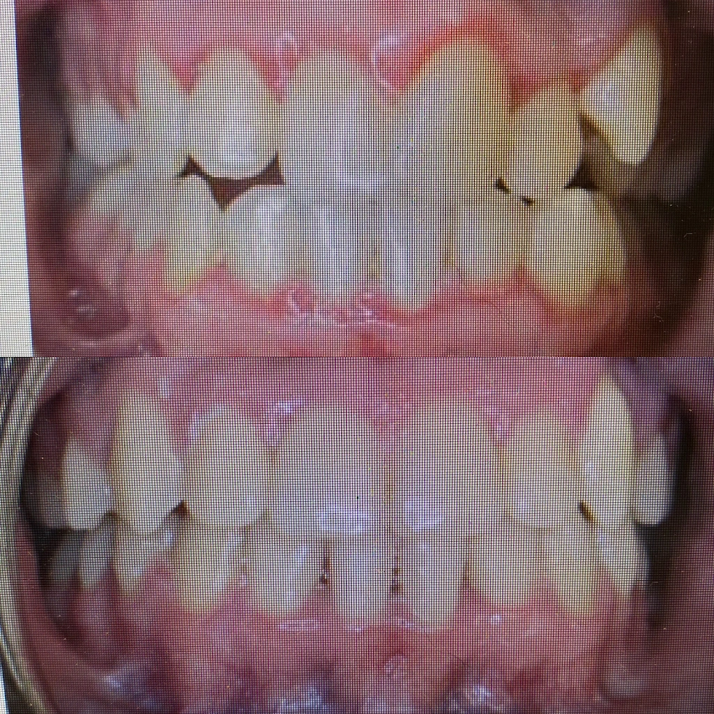 Nevada Dentistry & Braces