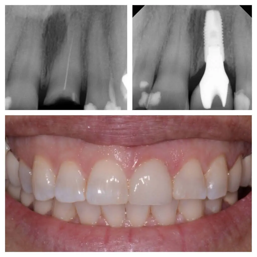 Rose Cosmetic & Family Dentistry
