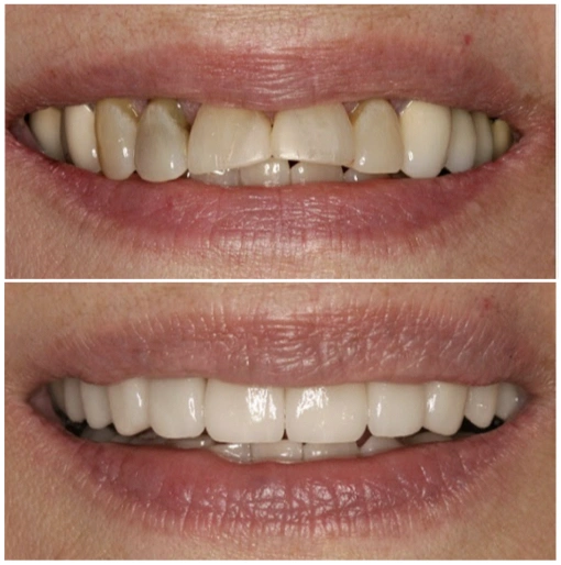 Rose Cosmetic & Family Dentistry