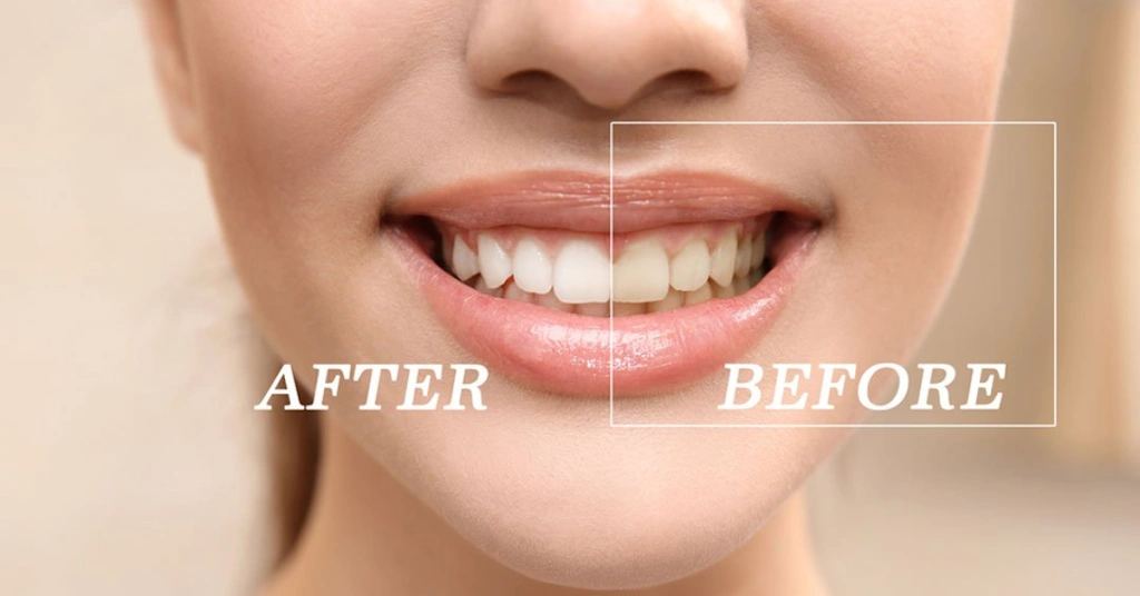 Boca Dental and Braces