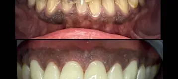 Desert Palms Dental