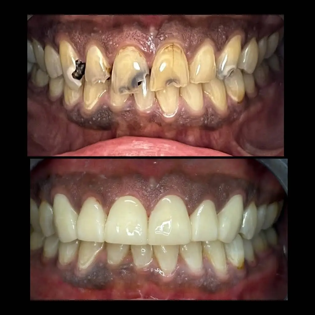Desert Palms Dental