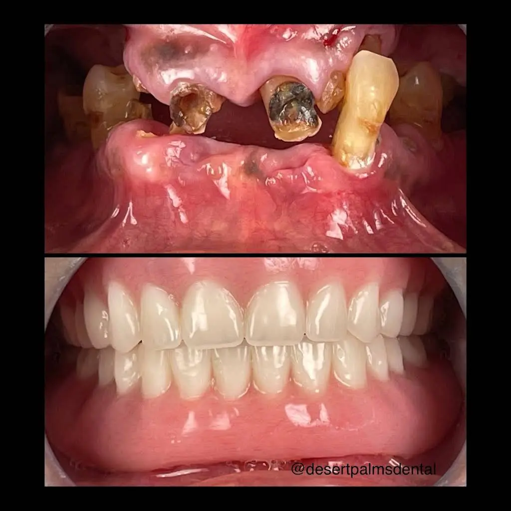 Desert Palms Dental