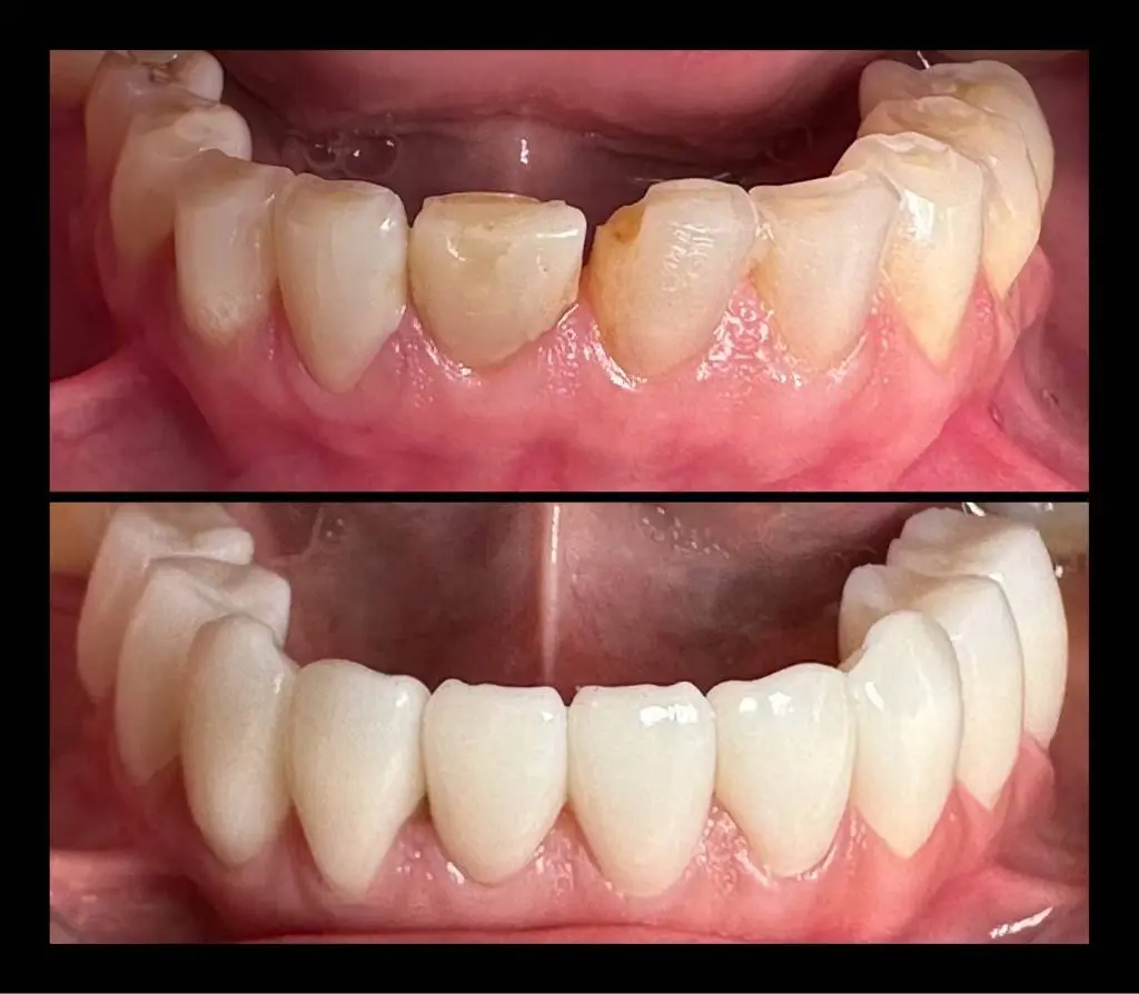 Desert Palms Dental