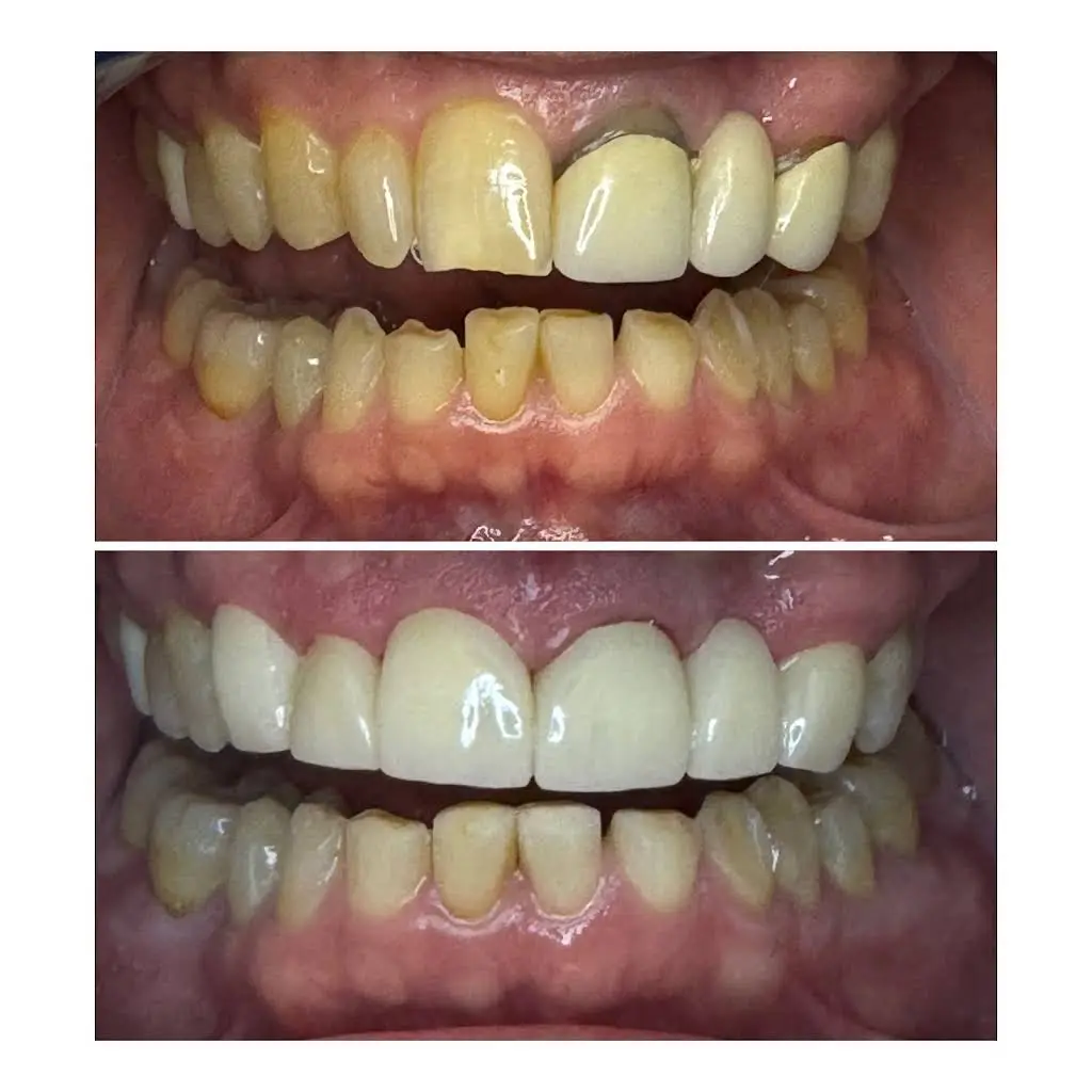 Desert Palms Dental