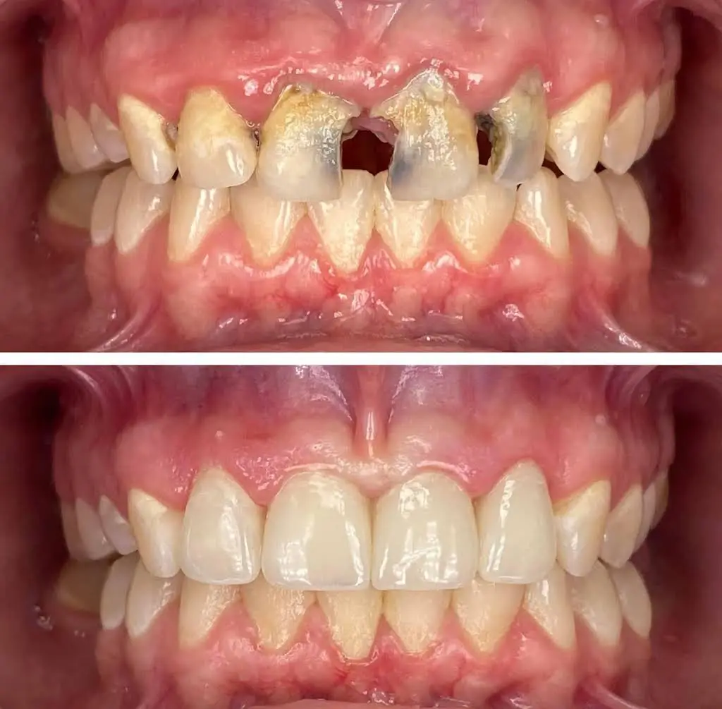 Desert Palms Dental