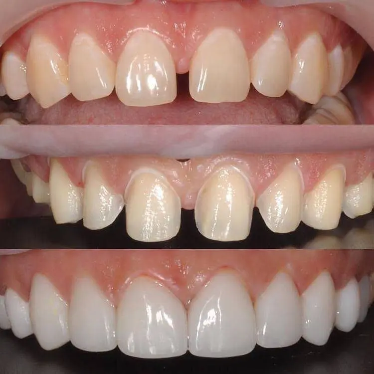 Redwood Dental Care