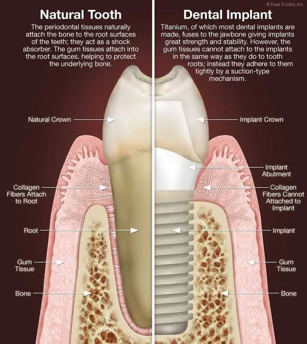 Redwood Dental Care