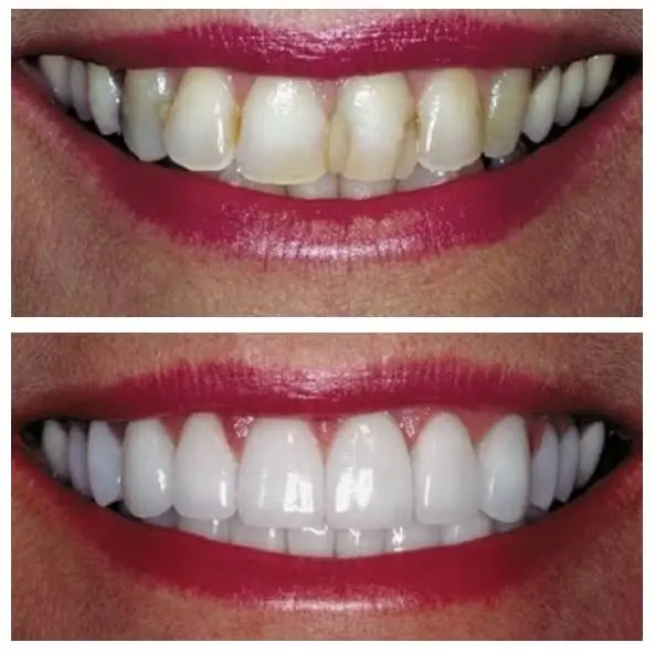 Redwood Dental Care