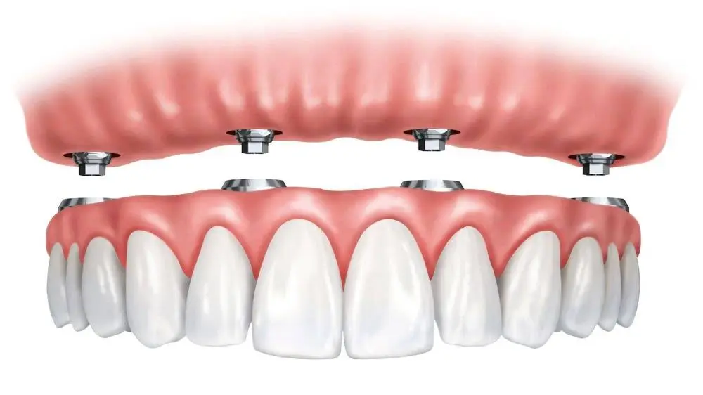 White Pine Dental