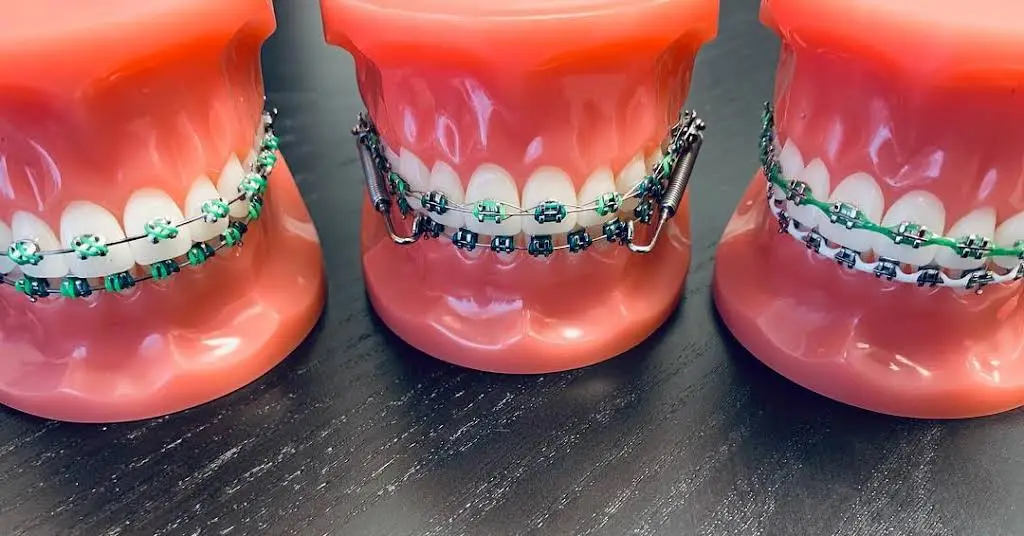 Smile Squad Kids Dentistry & Braces
