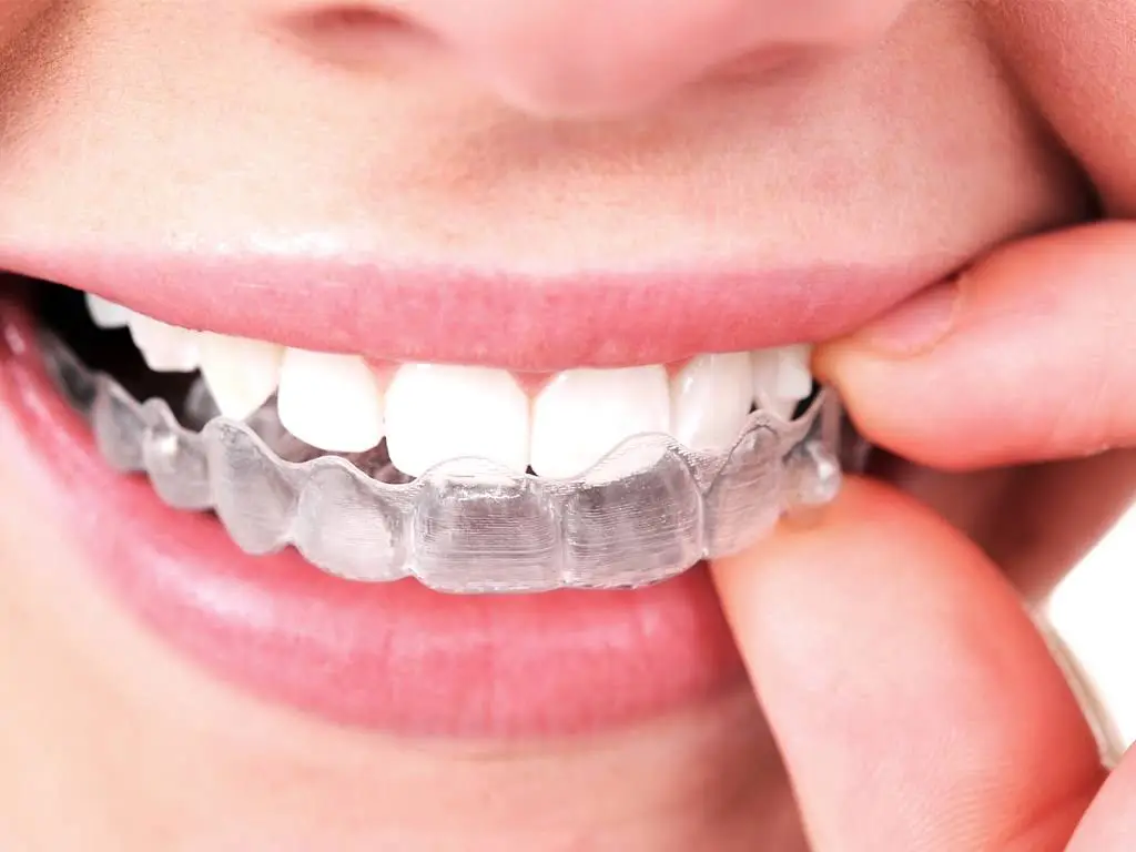 Smile Squad Kids Dentistry & Braces