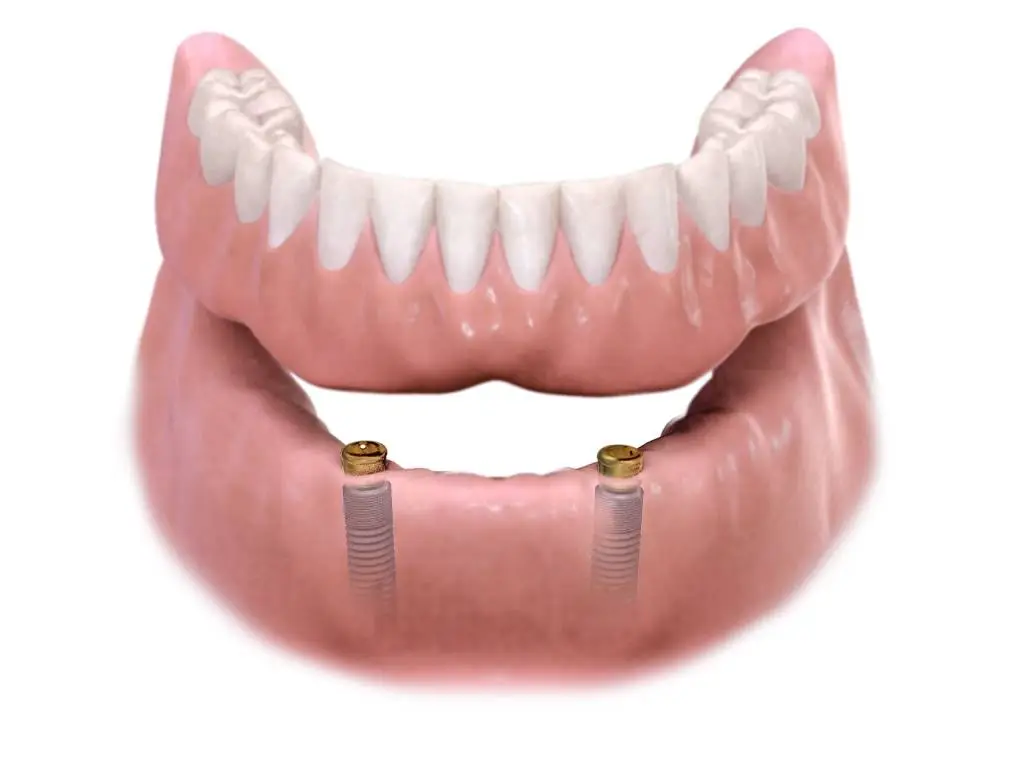 City Dental - Dental Implants and Orthodontics