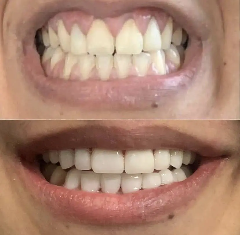 NLV Dental Group
