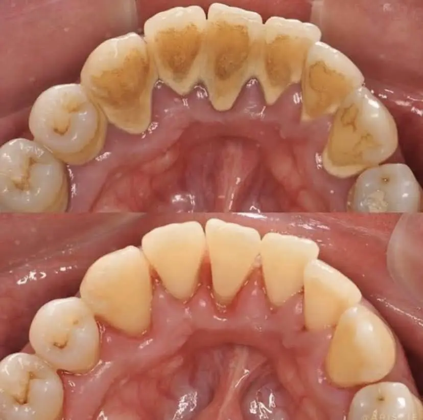 NLV Dental Group