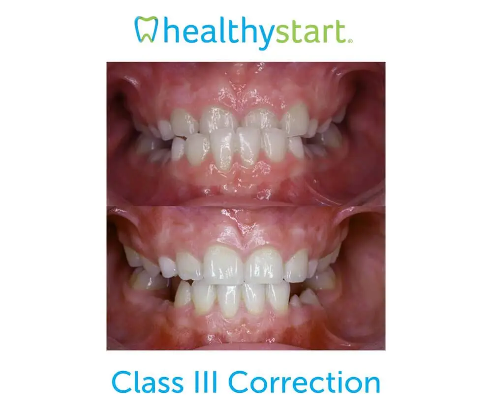Dee for Dentist