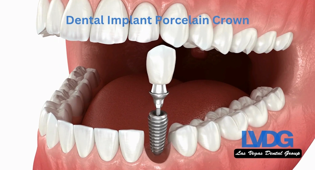 Las Vegas Dental Group