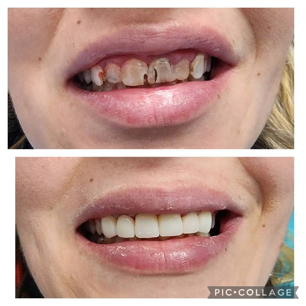 Perfect 32 Dental Care